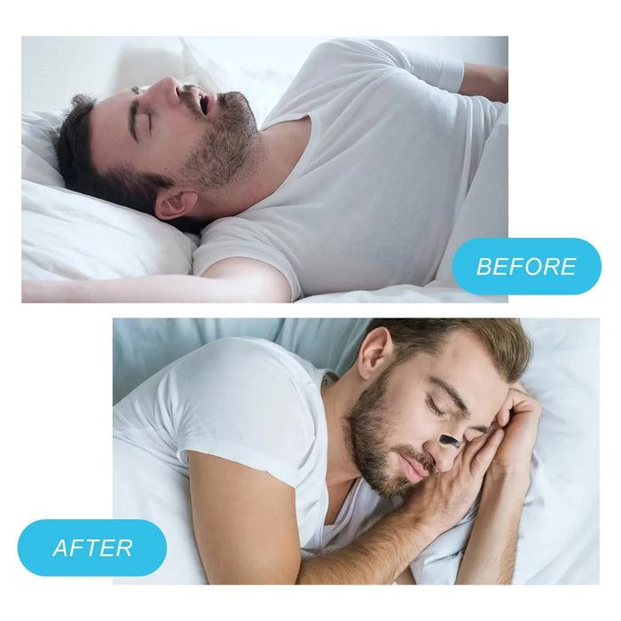 Magnetic Nasal Breathing Kit