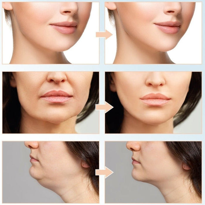 AgelessAura EMS Face Lifting Machine - Flamin' Fitness
