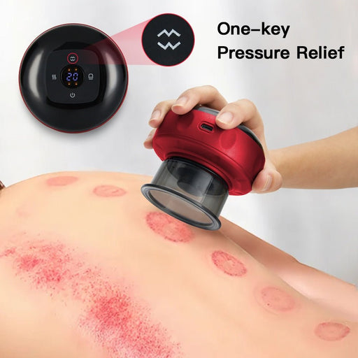 ProSuction Electric Cupping Set - Flamin' Fitness